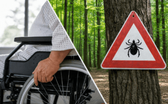Geteiltes Bild: Links die Hand einer Person an einem Rollstuhl, rechts ein Warnschild mit Zeckensymbol an einem Baum im Wald. Symbolische Darstellung von Mobilitätseinschränkung und Zeckenrisiko.