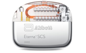 Eterna - Das weltweit kleinste implantierbare, wiederaufladbare SCS zur Behandlung chronischer Schmerzen