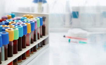 Workplace Rack with tubes of blood samples from patients in the Clinical Analysis laboratory of the hospital