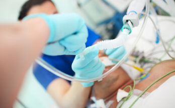 Medical doctor with assistant intubates male patient in the critical care unit.