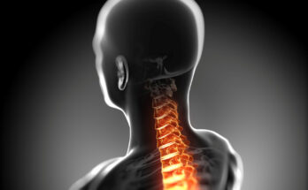 3d rendered anatomy illustration - painful back